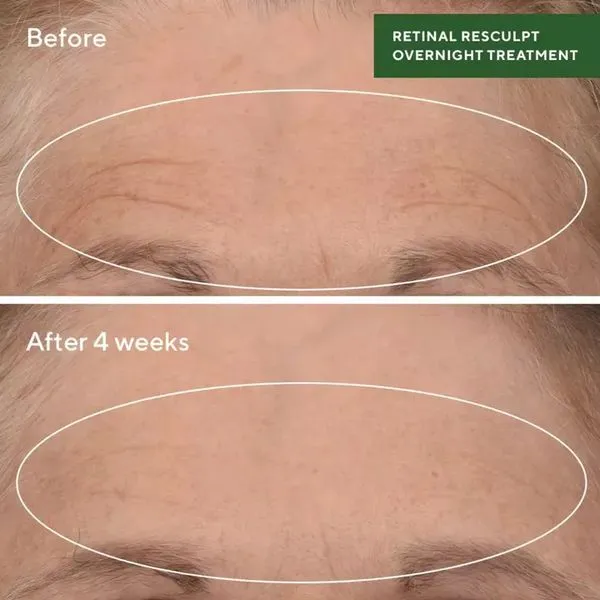 Murad Retinal ReSculpt Overnight Treatment