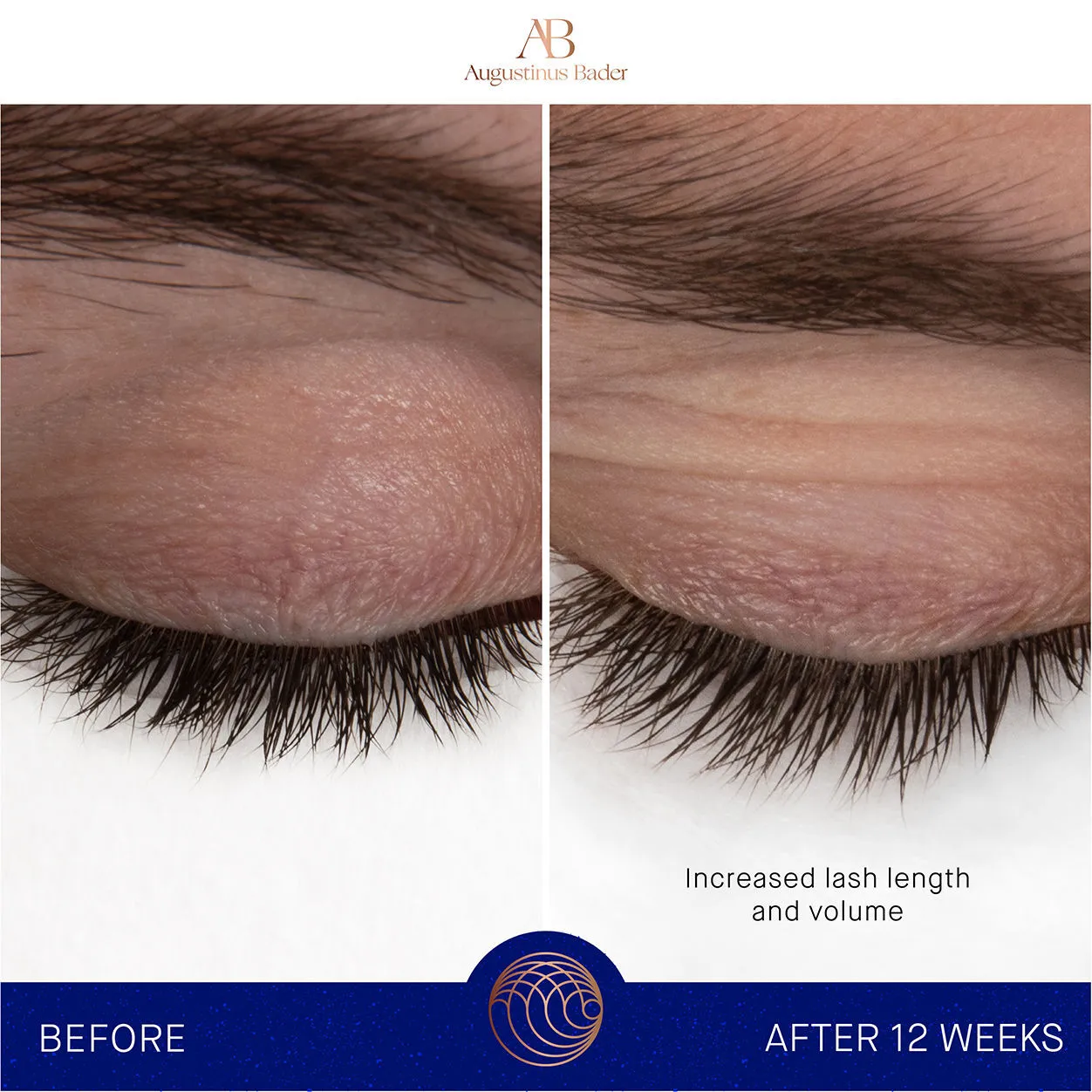 The Eyebrow and Lash Enhancing Serum